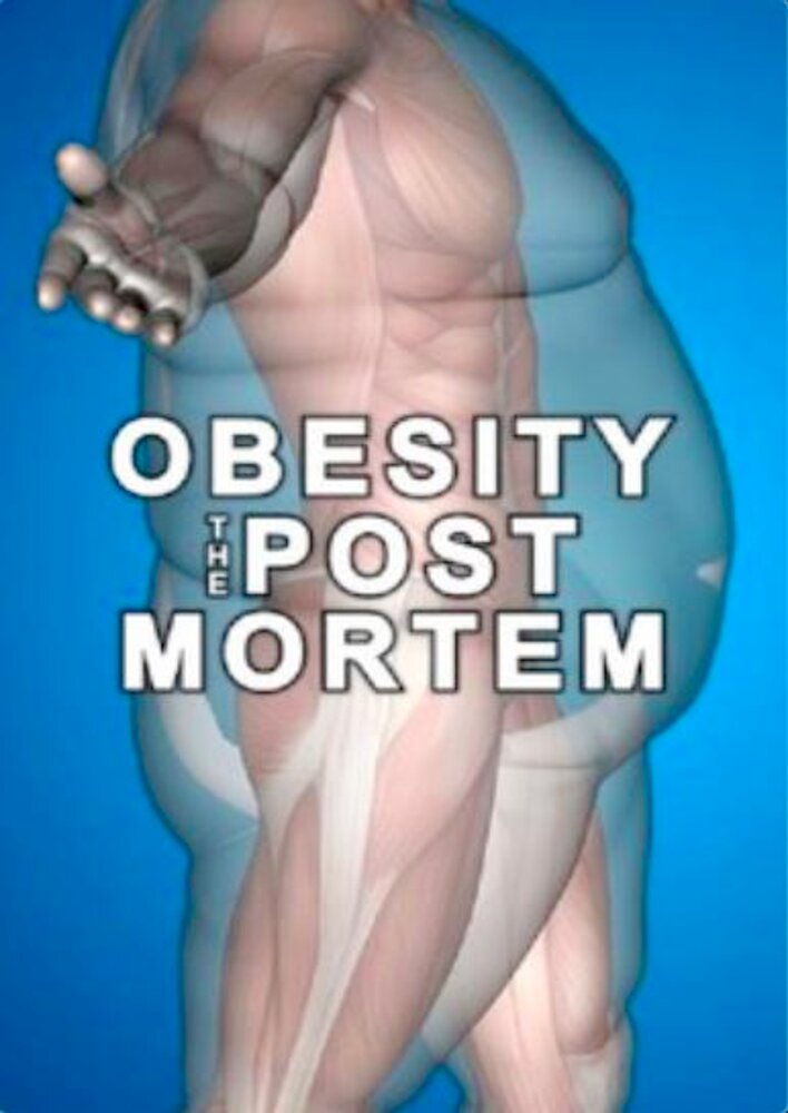 Obesity: The Post Mortem