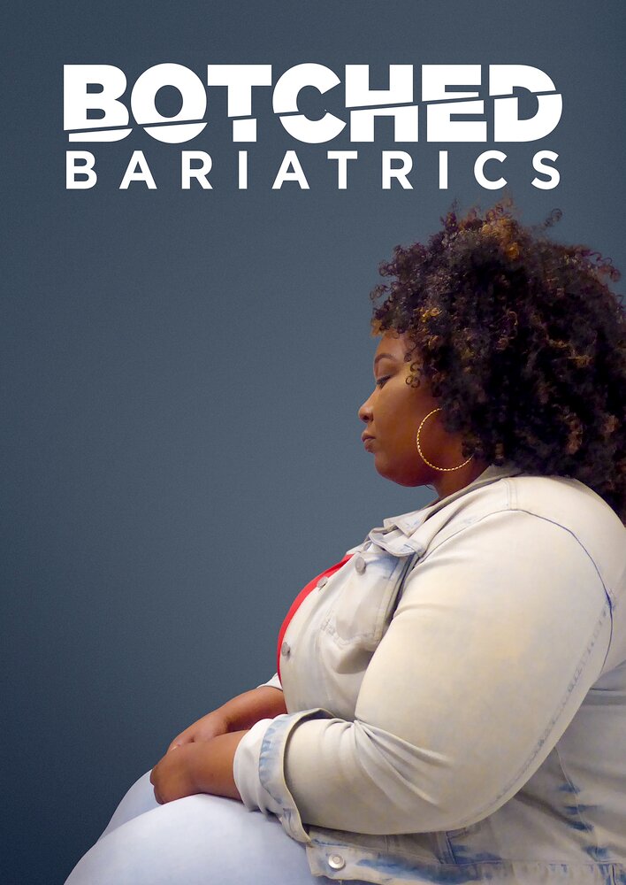 Botched Bariatrics