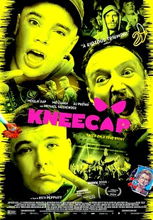 Kneecap