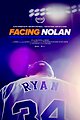 Facing Nolan